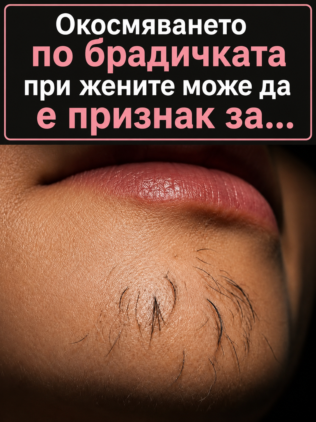 Окосмяването по брадичката при жените е признак за… 3 chatgpt image 14.07.2026 g. 09 05 31