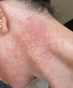 ❌Това са последиците от яденето на…. Вижте повече👇 2 526661691 772877265085508 7944957378473015383 n