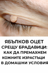 20251026 1456 yabalkov oczet i bradaviczi remix 01k8g9c36zfh89nyqzmmd3z125