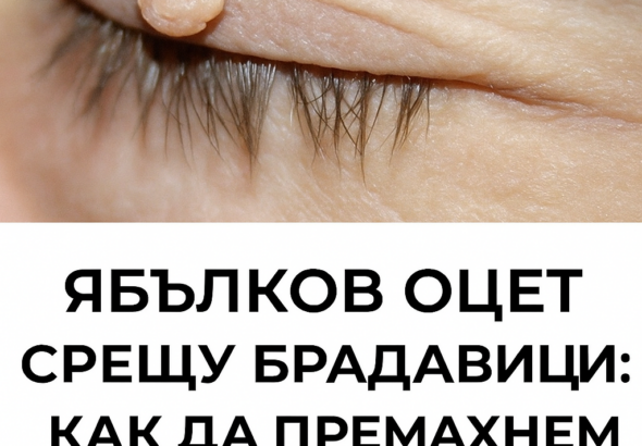 20251026 1456 yabalkov oczet i bradaviczi remix 01k8g9c36zfh89nyqzmmd3z125