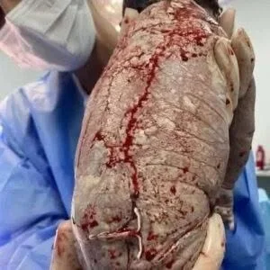 😱😱Бебе се роди с …Вижте повече 👇 26 518266572 759550323084869 8071172623959441341 n.jpg