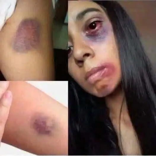 😭 Млада жена загина от ръката на своя… Вижте повече. 3 805936372 1019216334485931 53445
