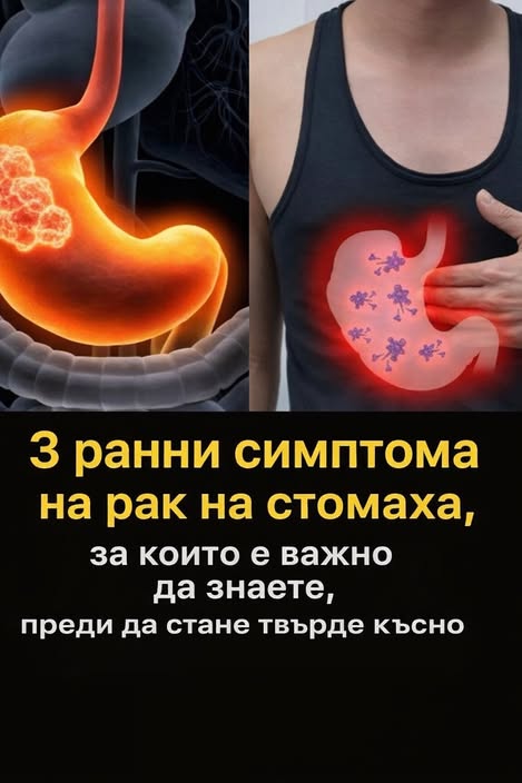 3 ранни симптома на рак на стомаха, за които е важно да знаете, преди да стане твърде късно 👇 3 819336051 1408147201512805 4772357274338908987 n