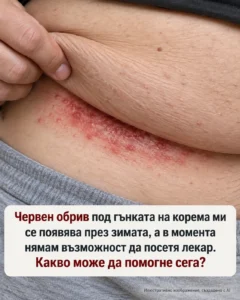 През зимата постоянно ми се появява зачервен и раздразнен обрив в гънката под корема, а в момента нямам възможност да посетя лекар. Какво може да помогне още сега? Пълната статия 👇💬 8 96641f96 2217 4af0 b397 88a5b70e